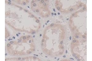 Immunohistochemistry (IHC) image for anti-Fission 1 (FIS1) (AA 1-117) antibody (ABIN7436618)