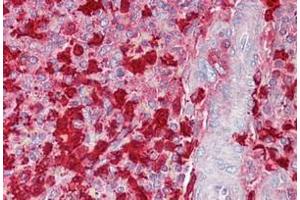Spleen stained in Immunohistochemistry on Paraffin Sections with S100A9 antibody (S100A9 antibody  (C-Term))