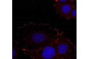 Immunofluorescence staining of methanol-fixed Hela cells using FAK(phospho-Tyr576/Tyr577) Antibody. (FAK antibody  (pTyr576, pTyr577))