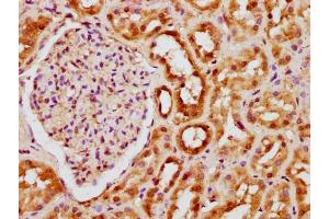 Immunohistochemistry (IHC) image for anti-Histone Cluster 1, H3a (HIST1H3A) (AA 50-61) antibody (ABIN7181548)
