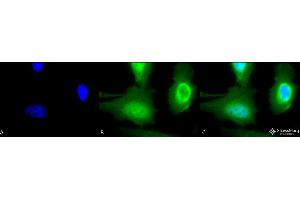 Immunocytochemistry/Immunofluorescence analysis using Rabbit Anti-Calreticulin Polyclonal Antibody . (Calreticulin antibody  (Atto 390))