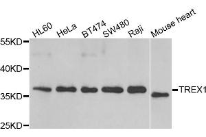 Western blot analysis of extracts of various cell lines, using TREX1 antibody (ABIN5974106) at 1/1000 dilution. (TREX1 antibody)