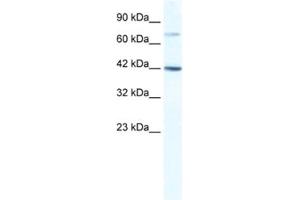 Western Blotting (WB) image for anti-GLI Family Zinc Finger Protein 4 (GLI4) antibody (ABIN2461601) (GLI4 antibody)