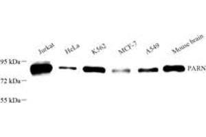 Western blot analysis of PARN (ABIN7075117),at dilution of 1: 1000 (PARN antibody)
