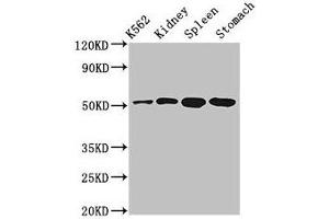 Western Blot Positive WB detected in: K562 whole cell lysate, Rat kidney tissue, Rat spleen tissue, Mouse stomach tissue All lanes: ALDH3B1 antibody at 3 μg/mL Secondary Goat polyclonal to rabbit IgG at 1/50000 dilution Predicted band size: 52, 48 kDa Observed band size: 52 kDa (ALDH3B1 antibody  (AA 168-449))