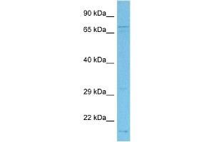 Host:  Rabbit  Target Name:  AMFR  Sample Tissue:  Human MDA-MB-435s Whole Cell  Antibody Dilution:  1ug/ml (AMFR antibody  (C-Term))