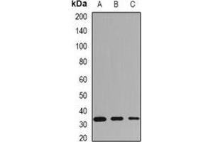 Western blot analysis of HLA-DRB1 expression in MCF7 (A), mouse spleen (B), mouse heart (C) whole cell lysates.