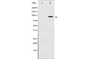 Western blot analysis of AhR phosphorylation expression in HepG2 whole cell lysates,The lane on the left is treated with the antigen-specific peptide.