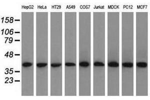 Image no. 8 for anti-Acetyl-CoA Acetyltransferase 2 (ACAT2) antibody (ABIN1496400) (ACAT2 antibody)