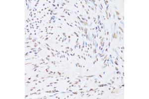 Immunohistochemistry (Paraffin-embedded Sections) (IHC (p)) image for anti-Heterogeneous Nuclear Ribonucleoprotein D (HNRNPD) (AA 1-306) antibody (ABIN6141905)