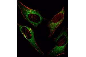 Fluorescent image of Hela cell stained with DDIT3 Antibody (C-term ) (ABIN655895 and ABIN2845295)/SA101207. (DDIT3 antibody  (C-Term))