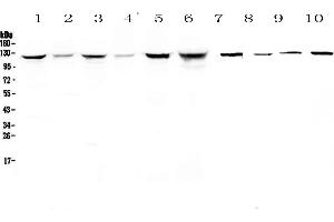 Western blot analysis of IDE using anti-IDE antibody . (IDE antibody  (AA 485-756))