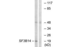 Western blot analysis of extracts from HepG2 cells, using SF3B14 antibody. (Pre-mRNA Branch Site Protein p14 (SF3B14) (C-Term) antibody)