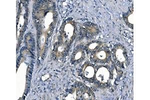IHC analysis of ASS1 using anti-ASS1 antibody (ABIN7601191). (ASS1 antibody  (AA 3-365))