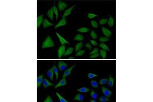 Immunofluorescence analysis of MCF7 cells using ATOX1 Polyclonal Antibody (ATOX1 antibody)