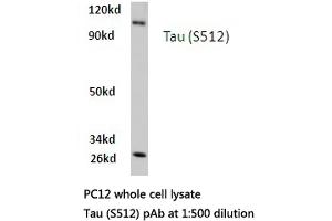 Western blot (WB) analysis of Tau antibody in extracts from PC12 cells. (MAPT antibody)