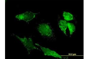 Immunofluorescence of purified MaxPab antibody to PDHX on HeLa cell.