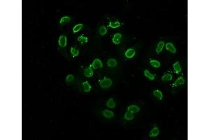 Immunofluorescence staining of Hela cells (treated with 30mM sodium butyrate for 4h) with ABIN7139147 at 1:2. (Histone H2B antibody  (acLys108))