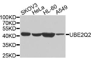 Western blot analysis of extracts of various cells, using UBE2Q2 antibody. (UBE2Q2 antibody)