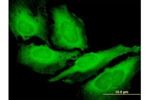 Immunofluorescence of purified MaxPab antibody to METAP2 on HeLa cell. (METAP2 antibody  (AA 1-478))