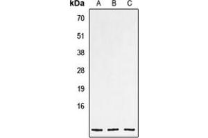 Western blot analysis of NPPC expression in HEK293T (A), mouse heart (B), rat heart (C) whole cell lysates. (NPPC antibody  (Center))