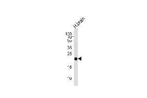 Western blot analysis of lysate from human brain tissue lysate, using CPLX3 Antibody (Center) (ABIN654609 and ABIN2844309). (CPLX3 antibody  (AA 52-81))