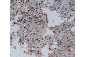 Used in DAB staining on fromalin fixed paraffin- embedded lung cancer tissue (LGALS13 antibody  (AA 1-139))