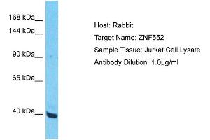 Host: Rabbit Target Name: ZNF552 Sample Type: Jurkat Whole Cell lysates Antibody Dilution: 1. (ZNF552 antibody  (Middle Region))