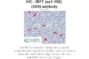 Image no. 1 for anti-Interferon Regulatory Factor 7 (IRF7) (AA 1-150) antibody (ABIN1723206)