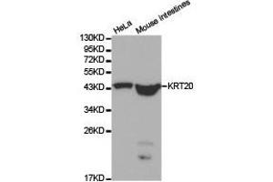 Western Blotting (WB) image for anti-Keratin 20 (KRT20) antibody (ABIN1873482)