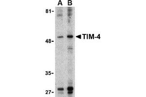Western blot analysis of TIM-4 in Jurkat lysate with TIM-4 antibody at (A) 1 and (B) 2 μg/ml. (TIMD4 antibody  (Center))
