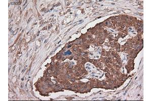 Immunohistochemical staining of paraffin-embedded kidney using anti-CPA1 (ABIN2452647) mouse monoclonal antibody. (CPA1 antibody  (AA 1-419))