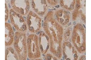 Immunohistochemical staining of formalin-fixed paraffin-embedded human fetal kidney tissue showing cytoplasmic and nuclear staining with PDCD5 polyclonal antibody  at 1 : 100 dilution. (PDCD5 antibody  (N-Term))