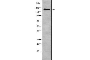 Western blot analysis NUP210L using COLO205 whole cell lysates (NUP210L antibody  (Internal Region))