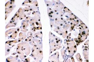 Immunohistochemistry (Paraffin-embedded Sections) (IHC (p)) image for anti-Parkinson Protein 7 (PARK7) (AA 2-189) antibody (ABIN3043589)