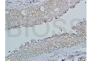Formalin-fixed and paraffin embedded rat ovary tissue labeled with Rabbit Anti-FSH receptor Polyclonal Antibody, Unconjugated (ABIN729508) 1:200 followed by conjugation to the secondary antibody and DAB staining. (FSHR antibody  (AA 201-300))