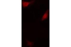 Immunofluorescent analysis of S6K1 staining in HepG2 cells. (RPS6KB1 antibody)
