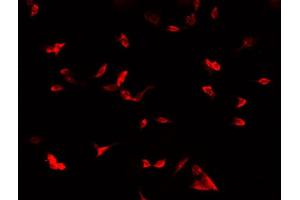 ABIN6269013 staining MCF-7 cells by IF/ICC. (COX IV antibody  (Internal Region))