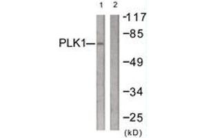 Western blot analysis of extracts from LOVO cells, treated with PMA 125ng/ml 30', using PLK1 (Ab-210) Antibody. (PLK1 antibody  (AA 176-225))