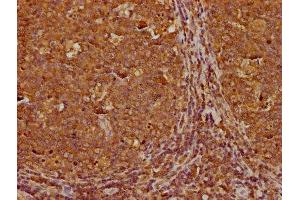 IHC image of ABIN7166965 diluted at 1:300 and staining in paraffin-embedded human tonsil tissue performed on a Leica BondTM system. (RABEP1 antibody  (AA 1-255))
