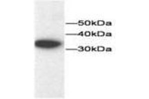 Image no. 1 for anti-Thioredoxin (TXN) antibody (ABIN791544) (TXN antibody)