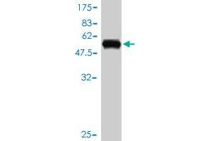 Western Blot detection against Immunogen (56. (ZNF277 antibody  (AA 1-278))