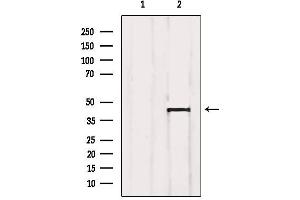 Western blot analysis of extracts from SP2/0, using Aurora Kinase Antibody. (Aurora A antibody  (Internal Region))