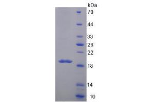 Image no. 1 for Mucin 5 Subtype B (MUC5B) (AA 6489-6632) protein (His tag) (ABIN6238624) (MUC5B Protein (AA 6489-6632) (His tag))