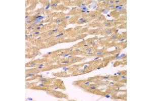 Immunohistochemistry of paraffin-embedded mouse heart using APLP1 antibody at dilution of 1:100 (x40 lens). (APLP1 antibody)