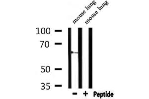 Western blot analysis of extracts from mouse lung, using CEACAM20 Antibody. (CEACAM20 antibody  (Internal Region))