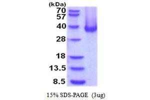 SDS-PAGE (SDS) image for Carbonic Anhydrase 12 (CA12) (AA 25-301) (Active) protein (His tag) (ABIN5854284)