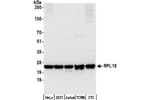 anti-Ribosomal Protein L18 (RPL18) (AA 1-50) antibody