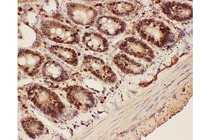 IHC-P testing of rat intestine tissue (Beclin 1 antibody  (AA 1-354))
