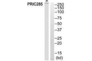 Western blot analysis of extracts from Jurkat cells, using PRIC285 antibody.
